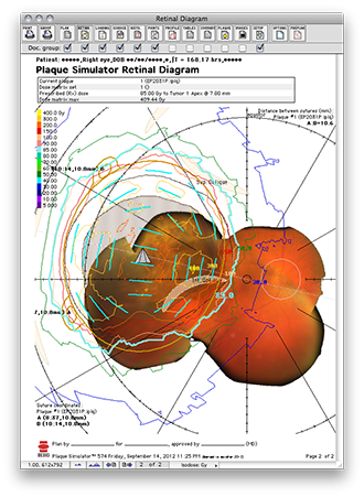 RetinalDiagramPage2