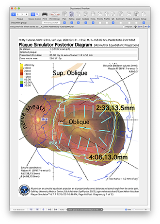 RetinalDiagramPage1
