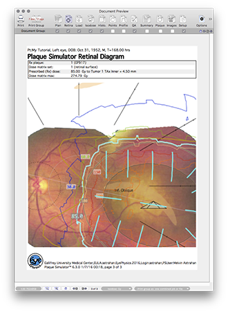 RetinalDiagramPage3