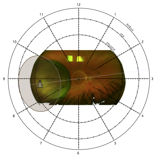 RetinalDiagram